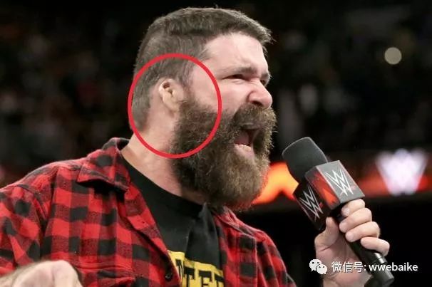 wwe的比赛很安全?他曾大战巨石强森,在赛后清理伤口半小时