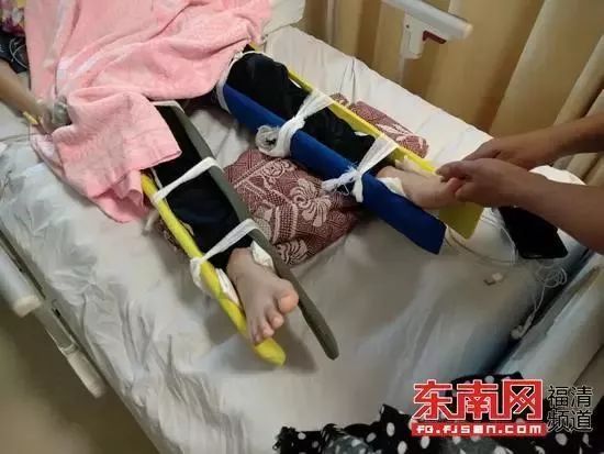 突发!福清发生一起车祸,13岁女孩双腿被撞断.