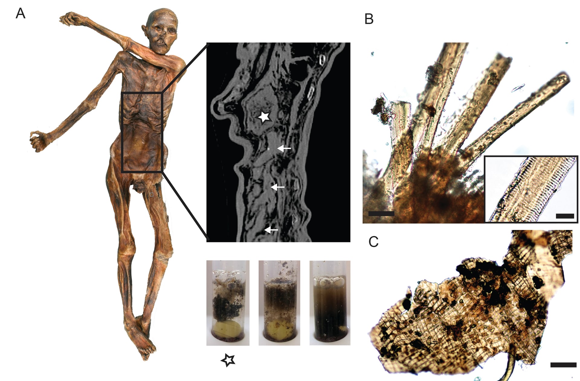 新研究:冰人奥兹死于5300年的一场谋杀,死前吃了一顿高脂肪大餐