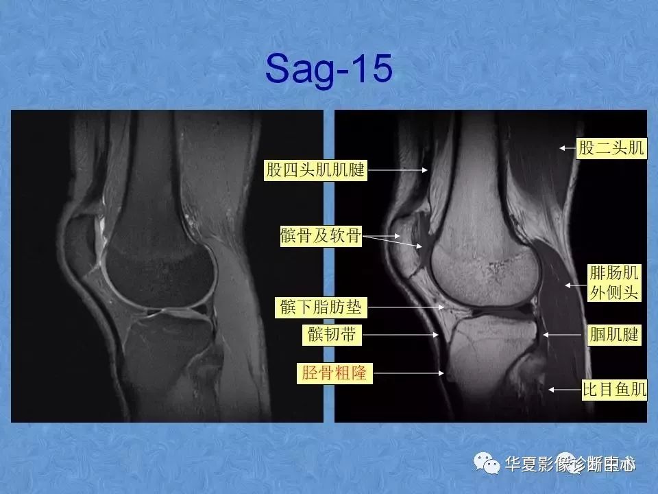 膝关节高清图