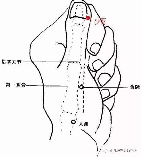 配合的穴位有:人中穴,合谷穴,十宣穴.