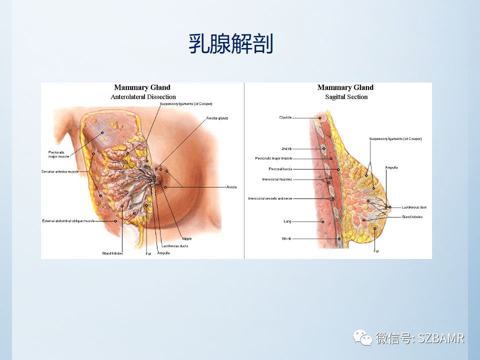 乳腺叶状肿瘤mri诊断