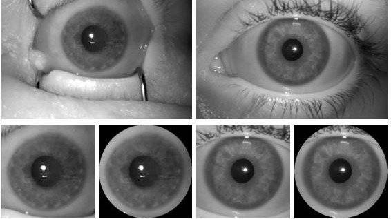 虹膜扫描仪得到改进可以识别死亡后的虹膜