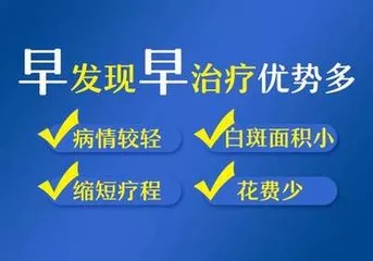 白癜风早治,晚治真的没区别吗?