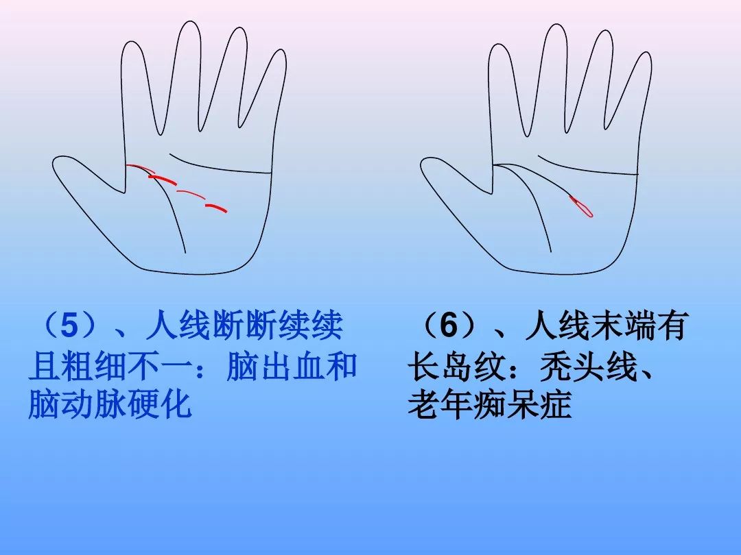 最全手诊图谱一看就懂非常实用