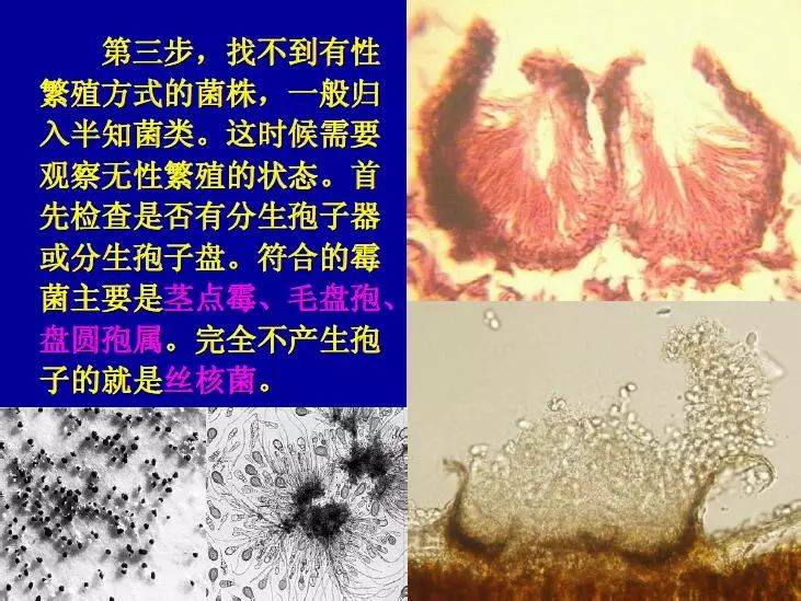 【建议收藏】常见霉菌分类鉴定