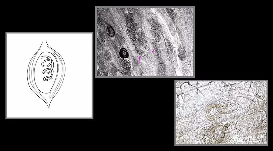 旋毛虫肌幼虫囊包标本he染色制作方法