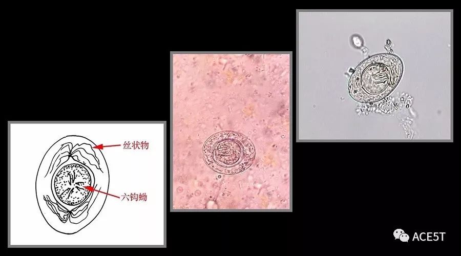 虫卵名字:细微膜壳绦虫卵 虫