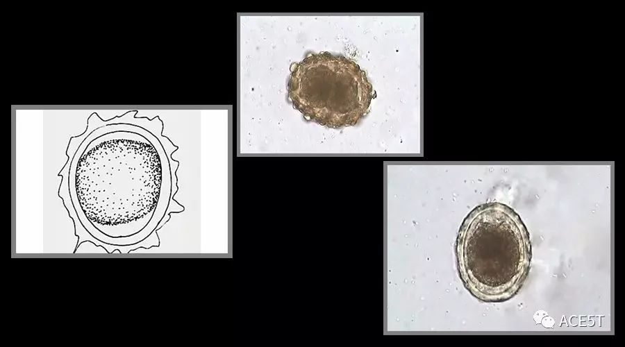 蛔虫的形态,结构特征是怎样的?