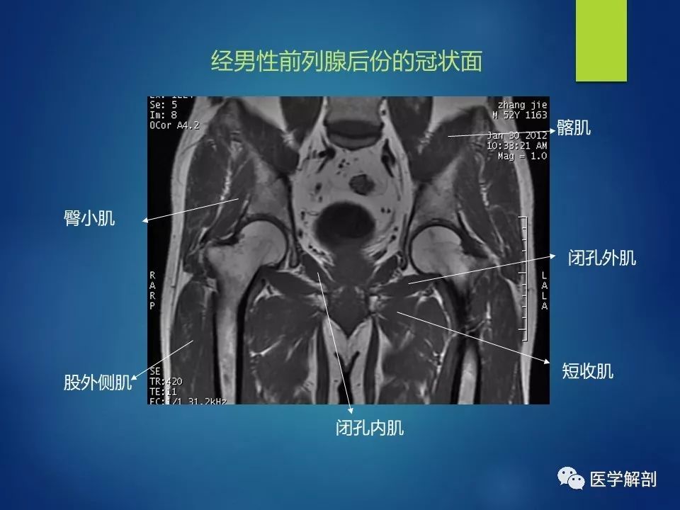 骨盆肌肉mr图谱