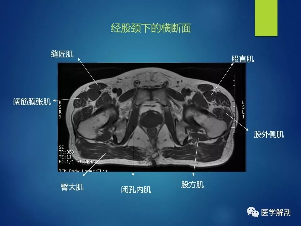 骨盆肌肉mr图谱