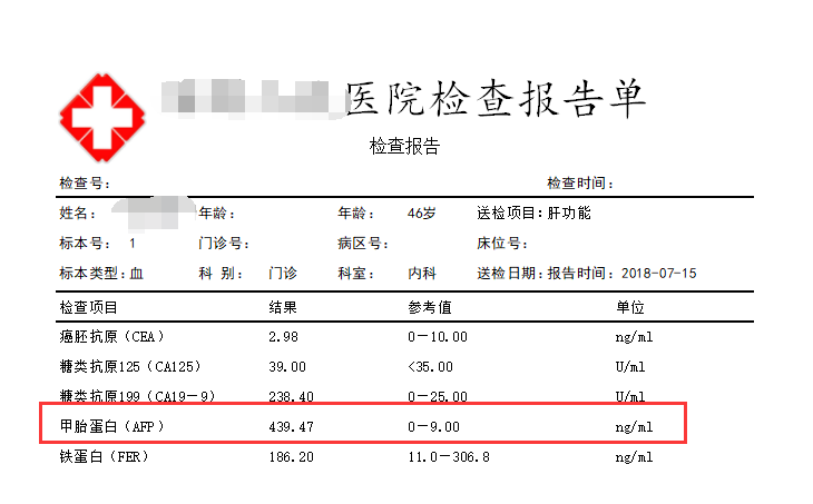 经常喝酒并已经患有酒精肝的人,如果近期出现没有明显原因的体重减轻