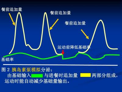 国产胰岛素泵好用吗?与进口胰岛素泵相比,有哪些优势?