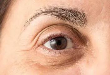 眼部是最容易衰老的,眼睛周围的皮肤要比面部皮肤早衰8年.
