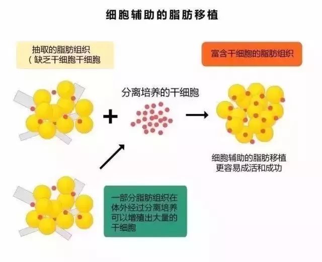 脂肪干细胞的优势:研究表明,干细胞有望继药物和手术之后,成为治疗多