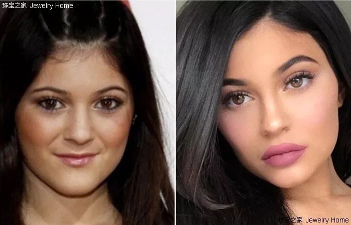 kylie jenner整容前,后