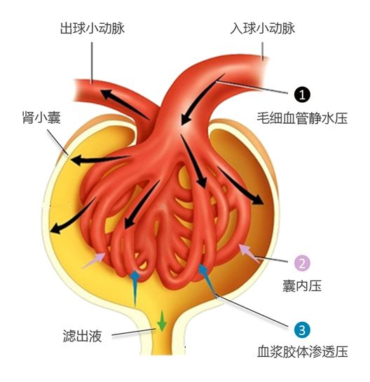 同时,肾小管浓缩功能受损,肾脏发生管球反应,导致入球小动脉收缩,微