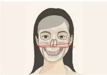 脸部不对称: 如果经常只用一边牙齿吃饭,会使这一侧的面部肌肉和颌骨