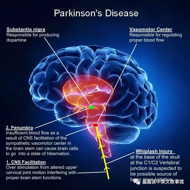 【晶闻社】 科普：Parkinson'sdisease 帕金森病【晶晶读中英文故事馆】