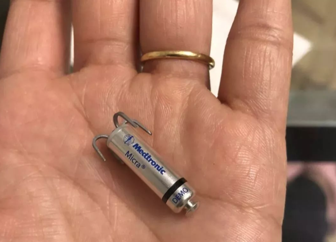 世界上最小的心脏起搏器