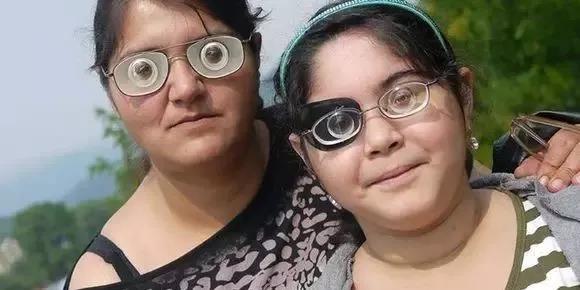 国外一女士在网上晒出了自己的近视眼镜,绝对令人震惊.