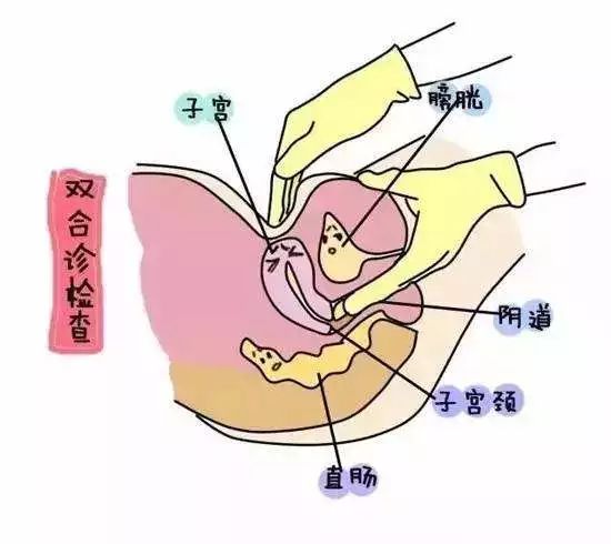 双合诊检查是阴道窥镜检查后要进行男医生更适合妇科的另个客观因素滴