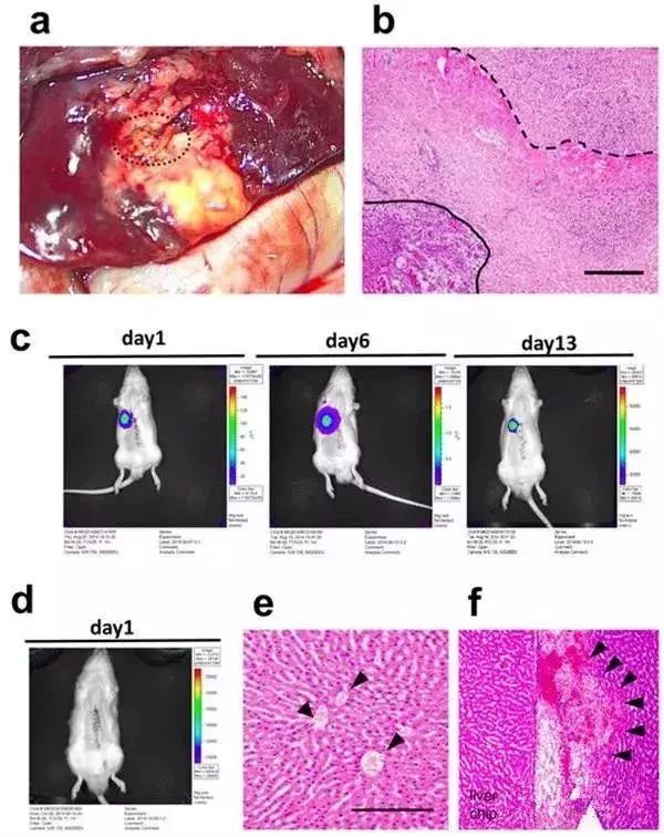 前方画面高能科学家成功移植3d打印肝组织于小鼠体内