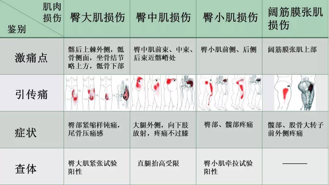 臀大肌损伤二