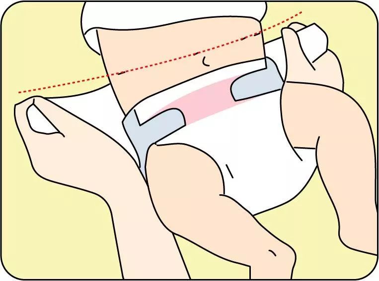 如何给宝宝换纸尿裤?图解纸尿裤正确穿法