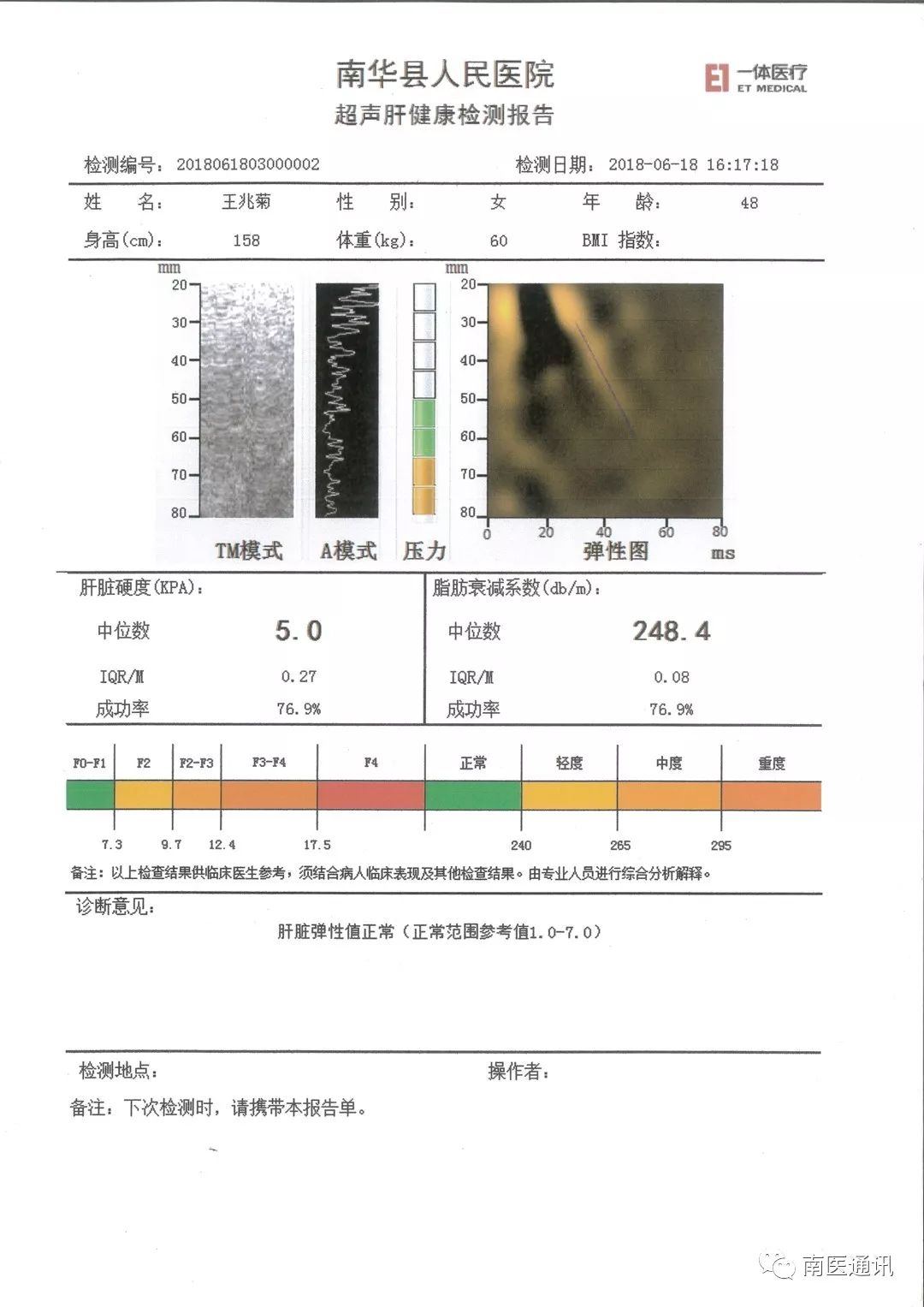 【南华县人民医院感染性疾病科】肝硬化检测仪