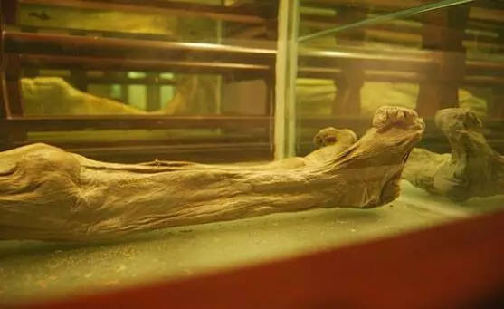 南宋末年福州一位贵妇人的干尸,这是一双正常的脚,完全没有缠足的痕迹