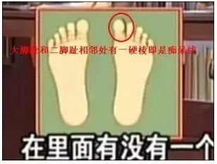 老年痴呆很可怕!预防原来这么简单,可惜很多人不知道!