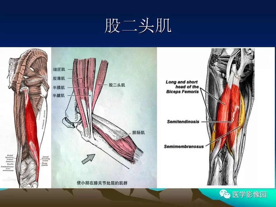 腘动脉陷迫综合征影像学诊断影像天地