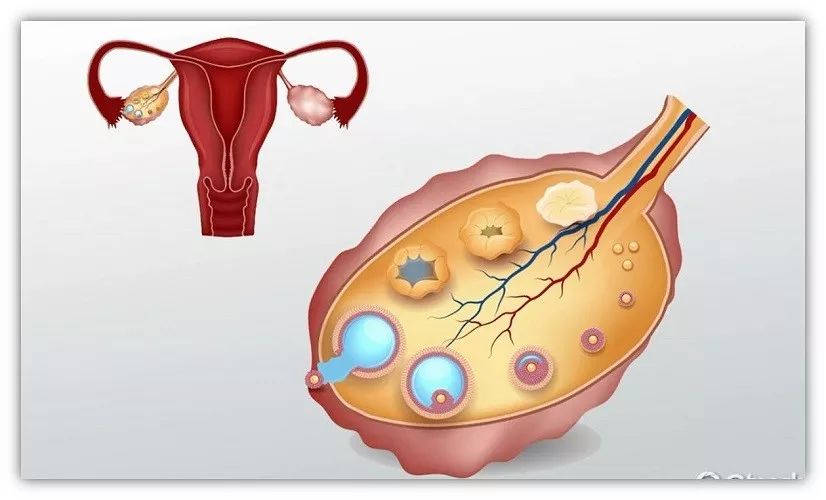 卵巢是非之地医学人文