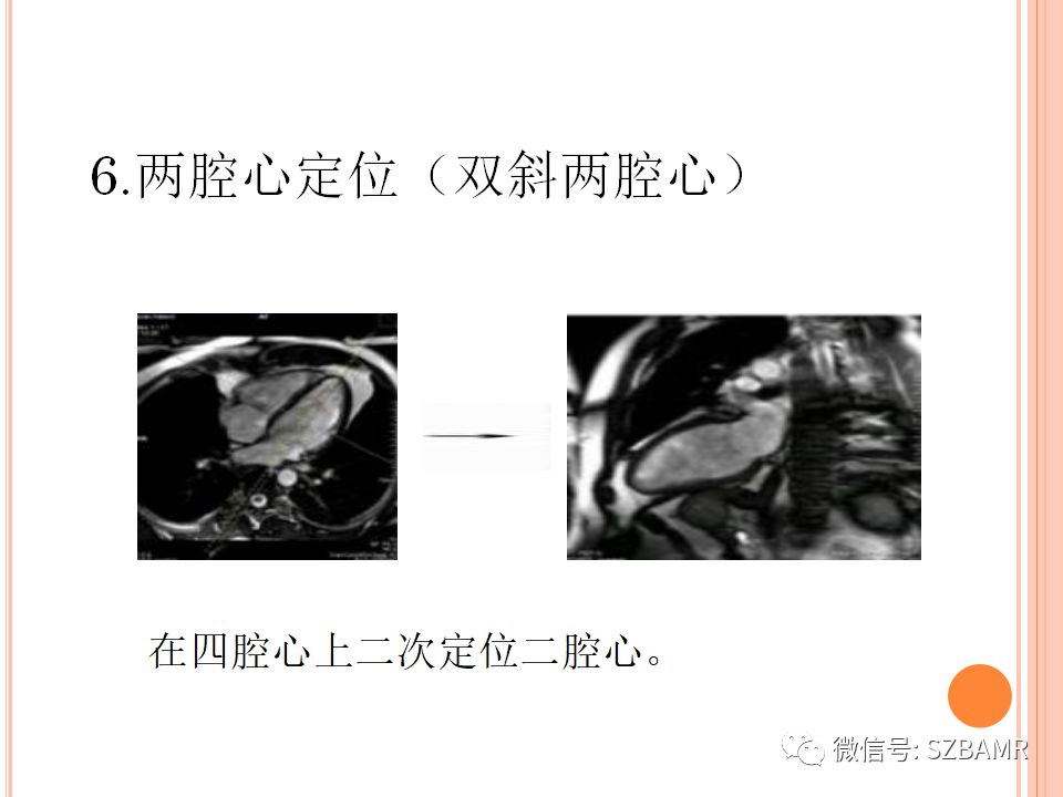 mr心脏扫描技术简介