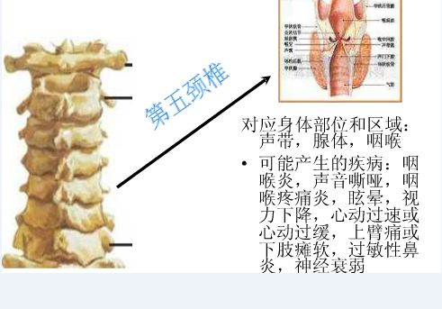 颈椎错位怎么办