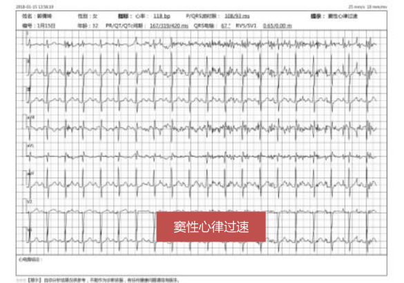 窦性心动过速严重吗?怎么办?