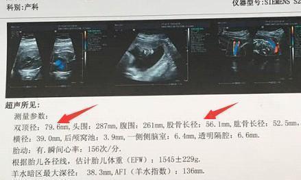 据说生男宝的孕妈在孕期有11种表现中7个以上的恭喜啦