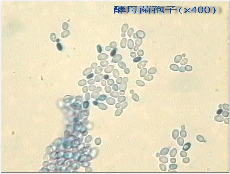 孟加拉红培基上酵母菌细菌菌落的鉴别方法附图