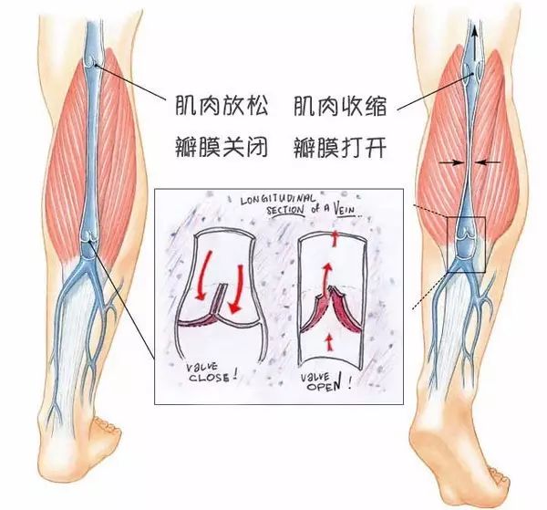 左小腿静脉曲张怎么办