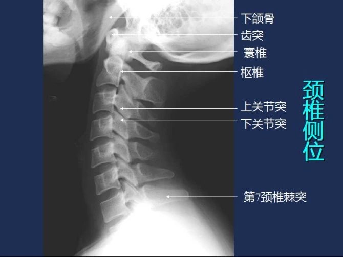 常规x线影像解剖大全