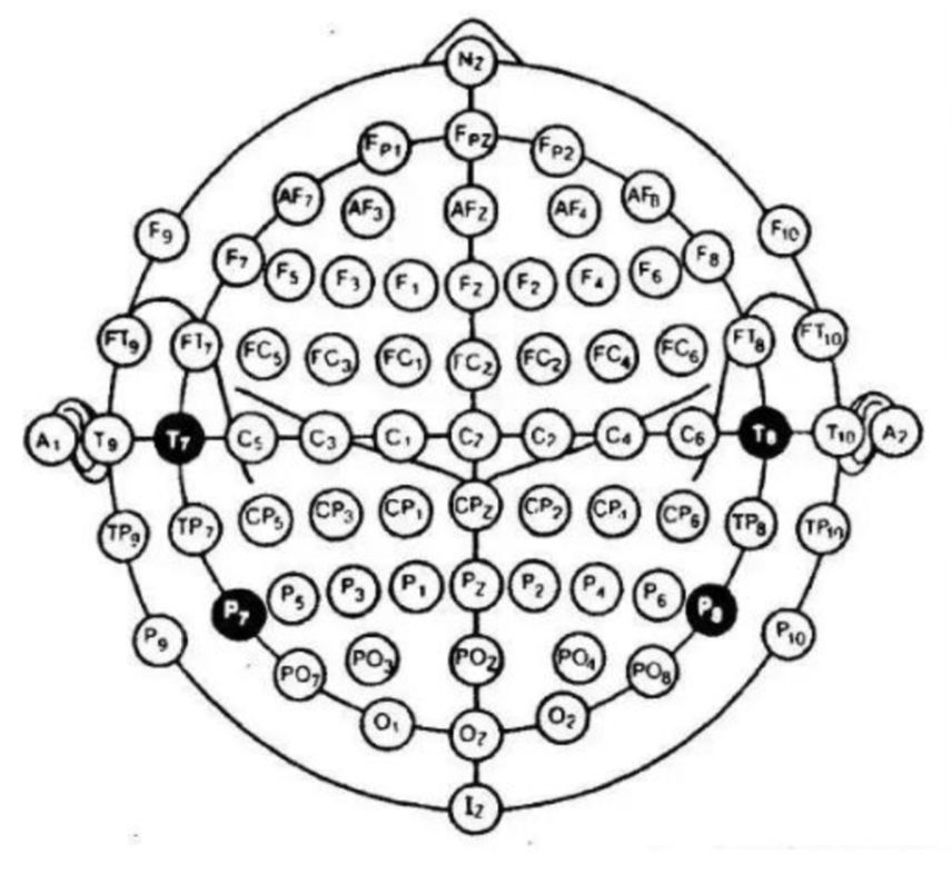 脑电图入门攻略