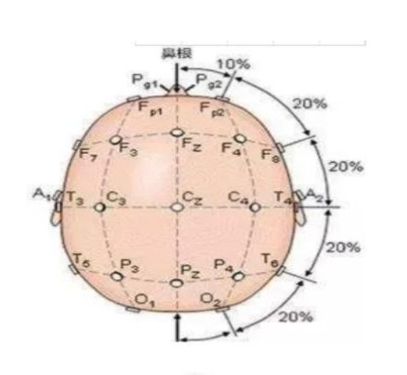 脑电图入门攻略