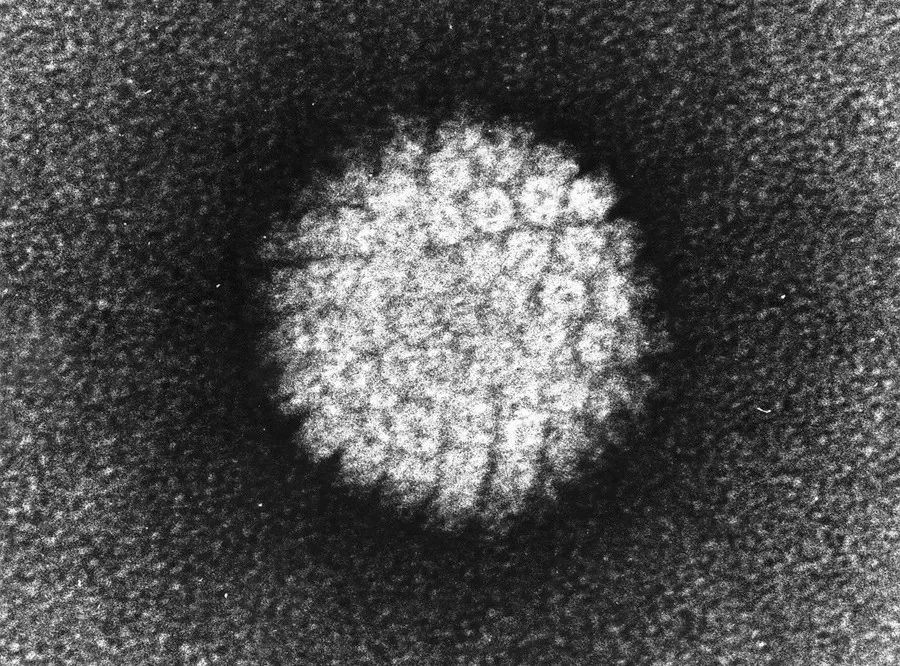 电子显微镜下的hpv病毒
