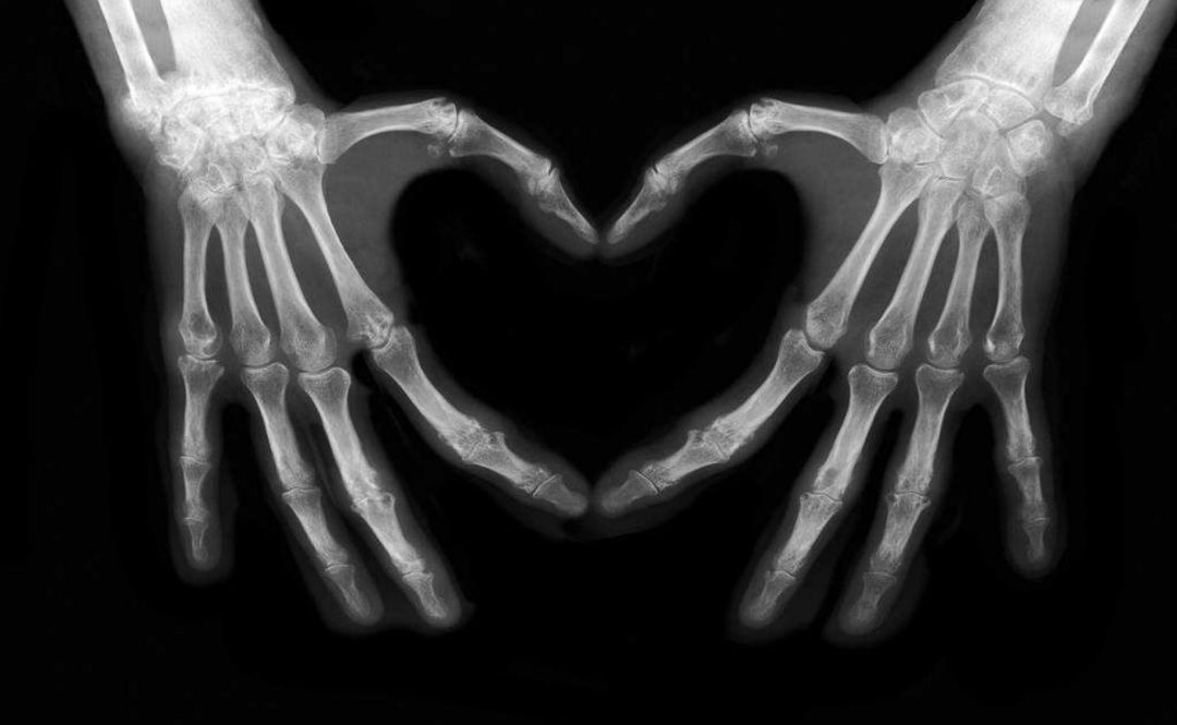 熊猫放射丨x线解剖及诊断知识点丨汇总