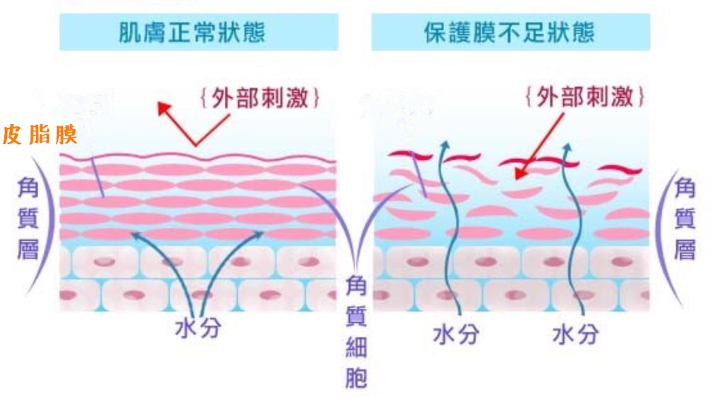 皮肤修复能力差怎么办