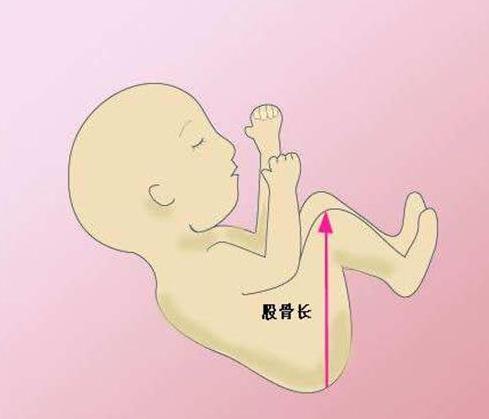 胎儿股骨长是什么意思
