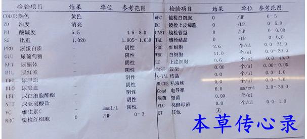 医生带你看糖尿病检查单