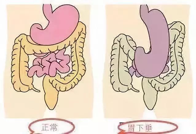 疾病预防 | 肚子痛"是哪种胃肠疾病缠上您!