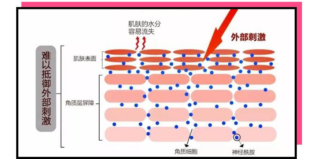 皮肤屏障受损的问题时